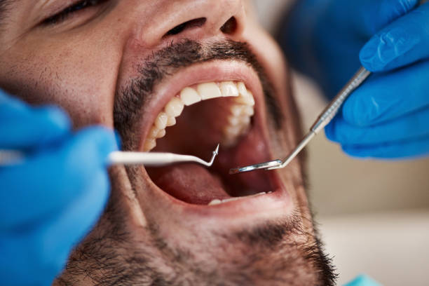 Best Cracked Tooth Emergency Dentist  in Grandview Plaza, KS